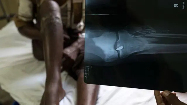 ரோஹிஞ்சா