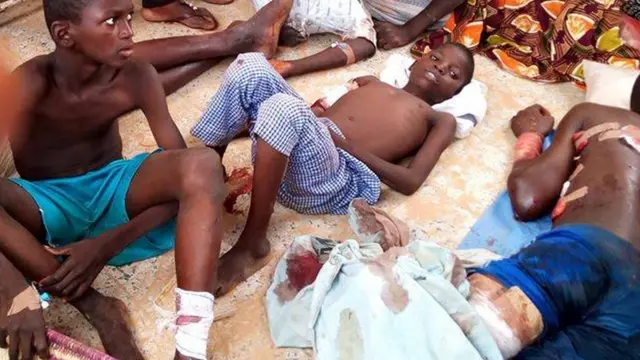 Survivors of di Zamfara attack wey dey receive treatment for hospital.