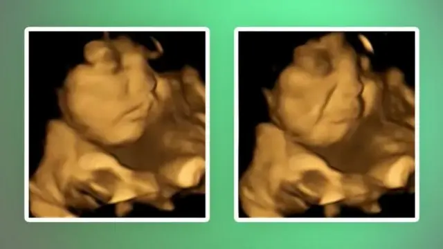 FETAL AND NEONATAL RESEARCH LAB/DURHAM UNIVERSITY