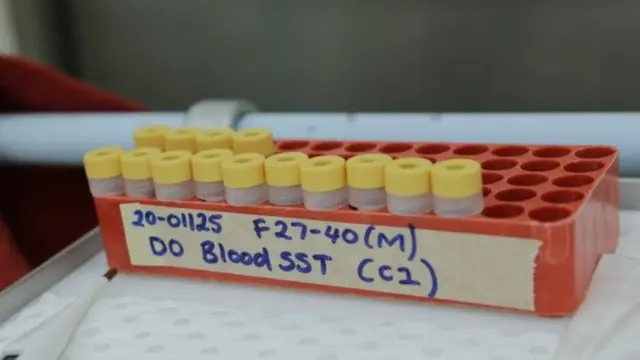 Inkingo ebyiri zishobora kuvamo iza Covid-19 nizo ziri kugeragezwa