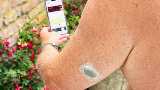 'भारत में टाइप-2 डायबिटीज़ का बढ़ता बोझ एक तरह से सार्वजनिक स्वास्थ्य आपातकाल है'