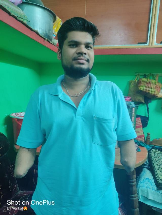 கை மாற்று அறுவை சிகிச்சை