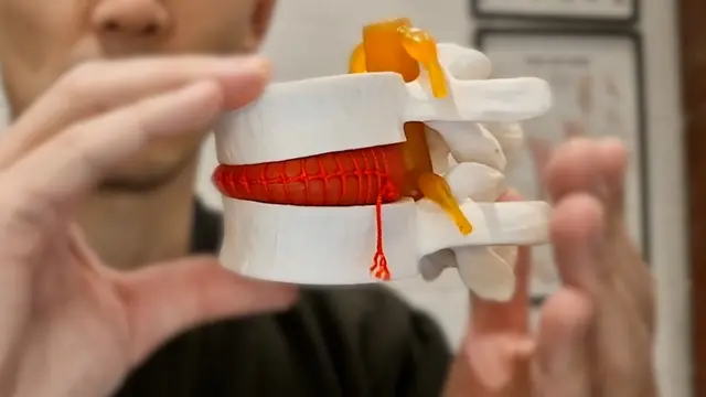 ਰੀੜ੍ਹ ਦੀ ਹੱਡੀ