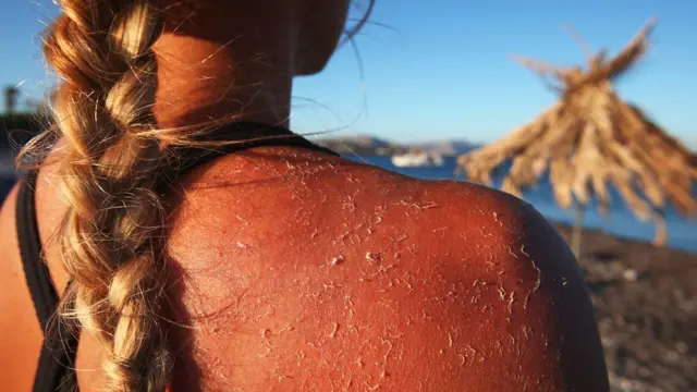 ብጸሓይ ዝተጎድአ ቈርበት ንስርዓታዊ ነድሪ ኣበርክቶ ዝገብሩ ኬሚካላት ብምፍናው ምስ ዕድመ ዝተኣሳሰር ሕማም ሓደጋ ክውስኽ ይገብር