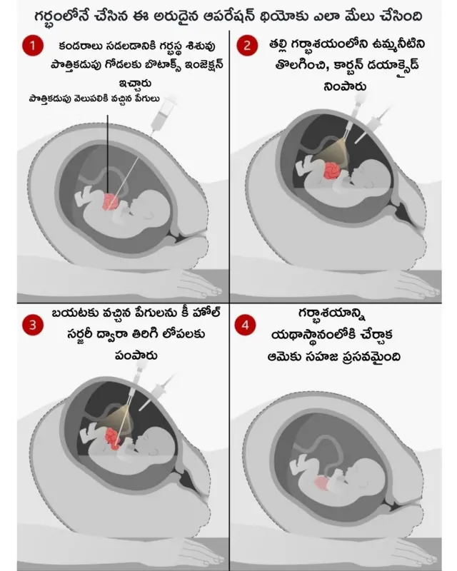 ఆపరేషన్ చేసిన తీరు 