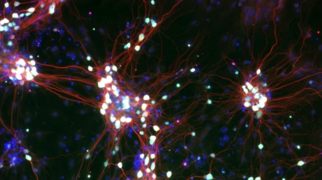 تصویر رنگی میکروسکوبی از سلول‌های عصبی