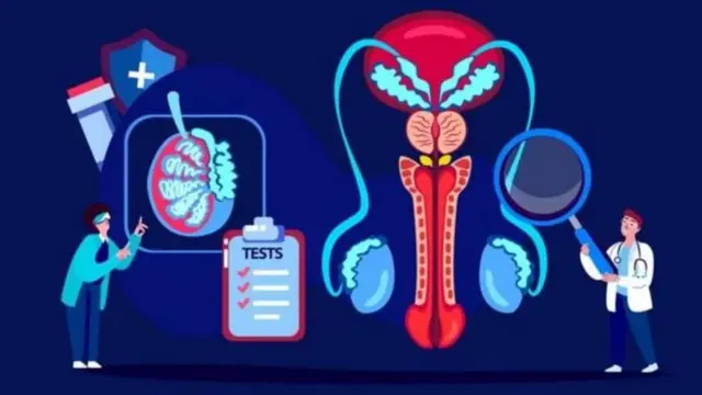 ప్రోస్టేట్ క్యాన్సర్