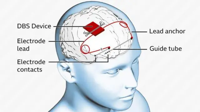 Aworan agbari ti wọn gbẹ ẹrọ igbalode si