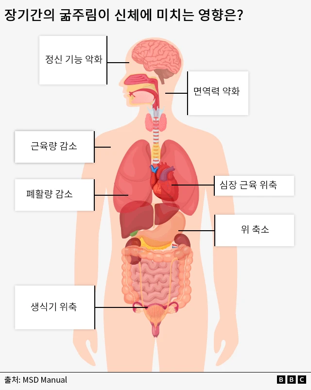 장기간의 굶주림이 신체에 미치는 영향
