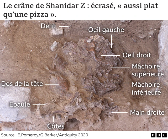 Image annotée montrant le crâne aplati