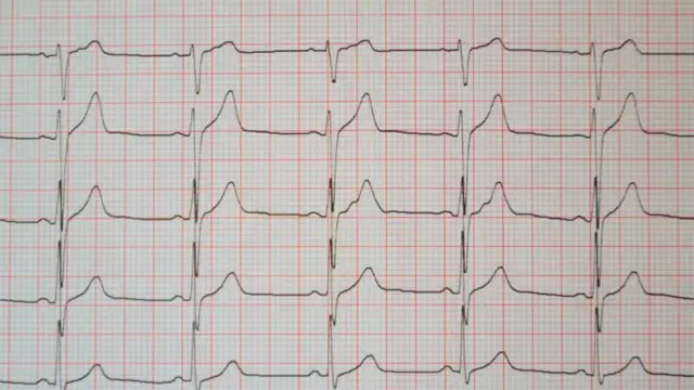 प्रातिनिधिक फोटो