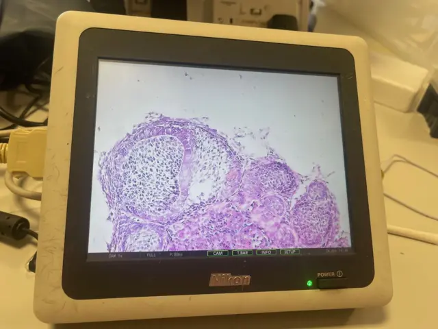 माइक्रोस्कोपमा देखिएका दन्तकोषिकाहरू
