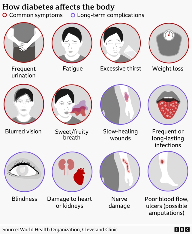 A graphic showing how diabetes affects the body. Common symptoms include frequent urination, fatigue, excessive thirst, weight loss, blurred vision and sweet/fruity breath. Long term symptoms include slow-healing wounds, frequent or long-lasting infections, blindness, damage to heart or kidneys, nerve damage and poor blood flow. 