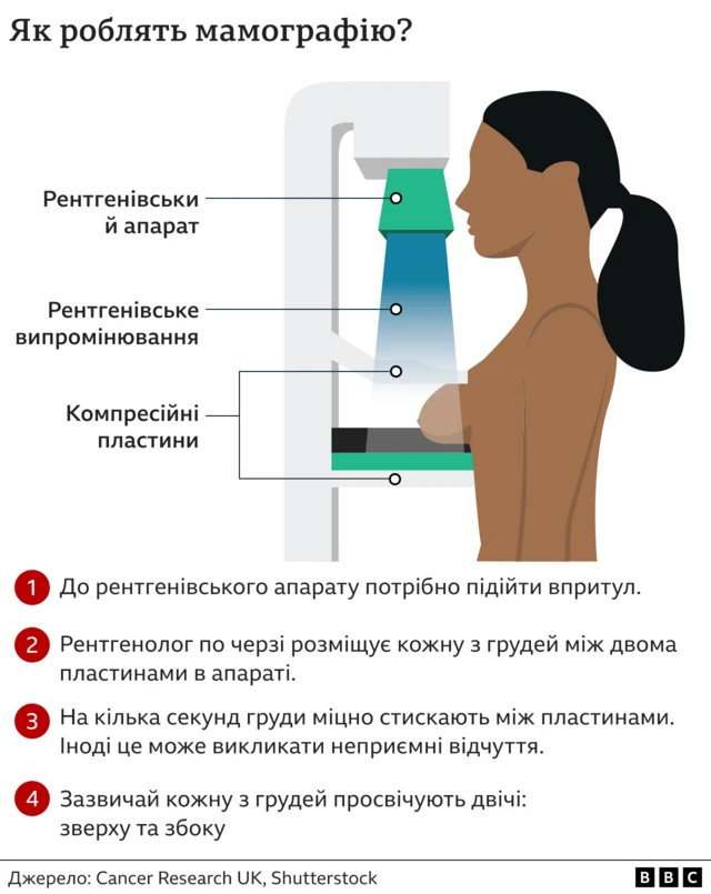 мамографія