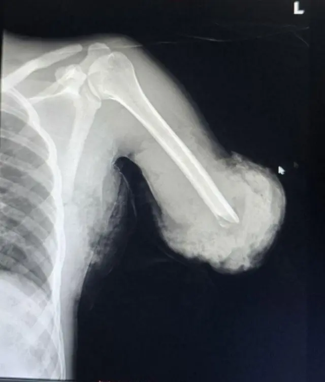 X-Ray nama harki citee