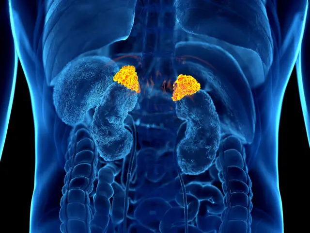 ਐਡਰੀਨਲ ਗ੍ਰੰਥੀ