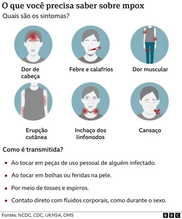 Gráfico mostra sintomas e transmissão da mpox