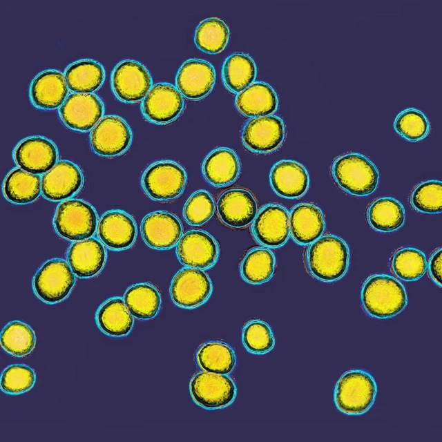 황색포도상구균을 현미경으로 확대해 찍은 사진
