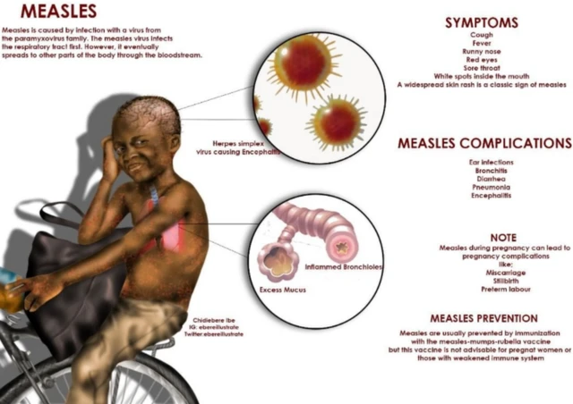 Eserese Chidiebere Ibe