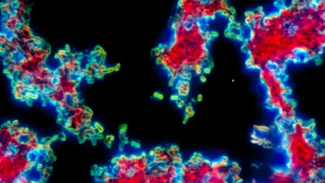 Бактерия Yersinia pestis