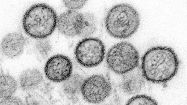 Imágen microscópica del virus
