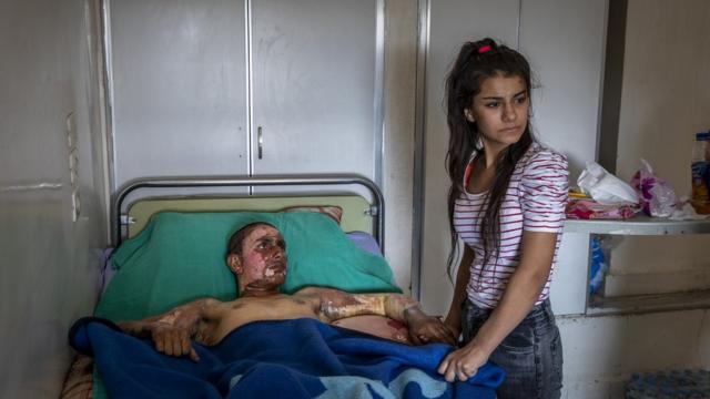 Ahmed Ibrahim, de 18 años y miembro de las Fuerzas Democráticas de Siria, gravemente quemado, recibe la visita de su novia en un hospital en al Hasakah (Siria), el 20 de octubre de 2019.