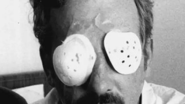 বিহারের ভাগলপুরে চোখে অ্যাসিড ঢেলে চিরতরে অন্ধ করে দেয়া হয়েছিল ত্রিশেরও বেশি লোককে (ফাইল ফটো)