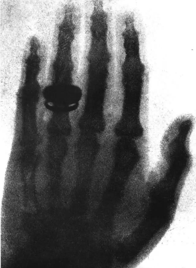 எக்ஸ் கதிர், ரான்ட்ஜென், நோபல் பரிசு