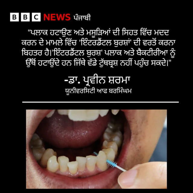 ਇੰਟਰਡੈਂਟਲ ਬੁਰਸ਼