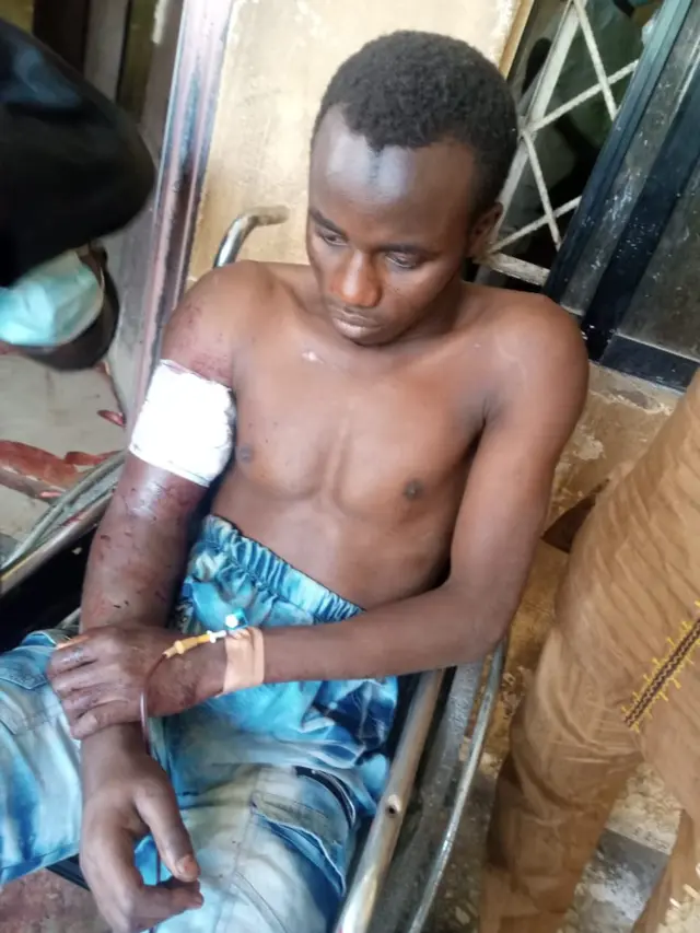 Dis na before hospital cut di arm comot