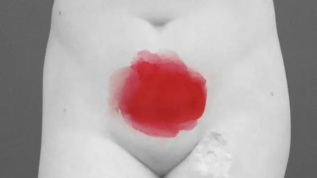 ਐਂਡੋਮੇਟ੍ਰੀਓਸਿਸ