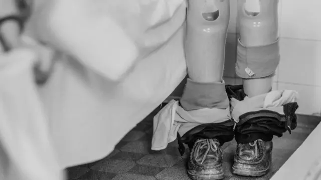 Crno-bela fotografija dečje protetike za noge