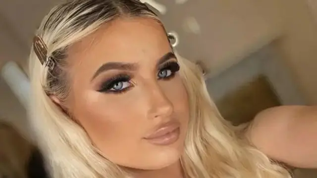 أصيبت إيزي بنزيف في اللثة وتقرحات على شفتيها بعد تكثيف عادتها في التدخين الإلكتروني