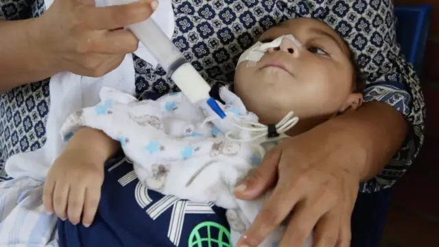 José Wesley, afectado por el virus del Zica, a los 16 meses de edad