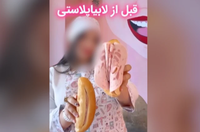 یک نما از تبلیغی که زنان را به انجام لابیاپلاستی تشویق می‌کند