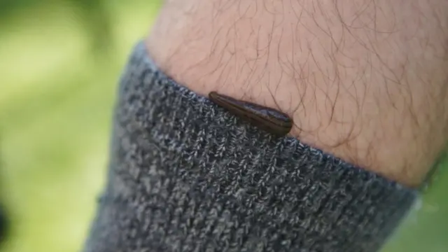 அட்டைகள் நம் ரத்தத்தை குடிக்கும்போது வலியே தெரியாதது ஏன்?