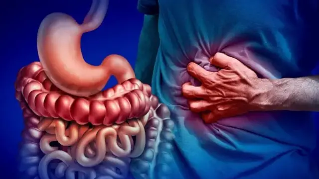 Hali hii husababisha kuhara na maumivu ya tumbo.