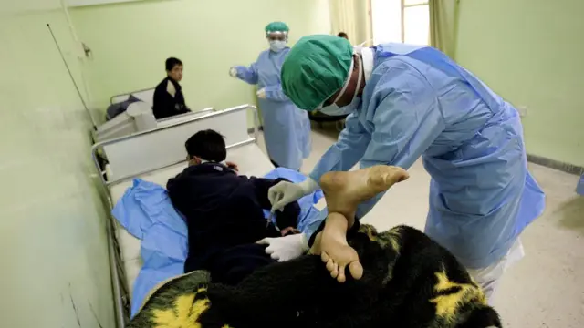 स्पाइनल फ्ल्यूड