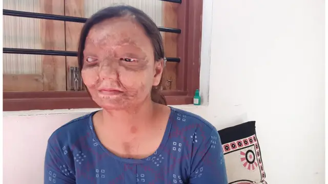 27 ઑપરેશન બાદ ફરી પાછી મળી દૃષ્ટિ