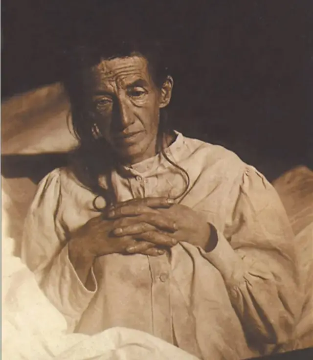 어거스트 데터는 1900년대 초에 최초로 알츠하이머 진단을 받은 환자다