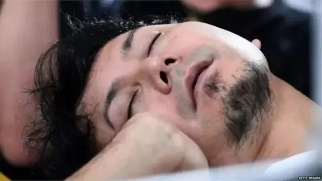 గురక పెట్టకుండా ఉండాలంటే