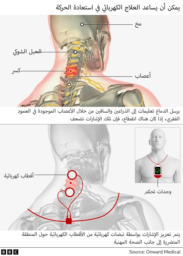 صورة توضيحية