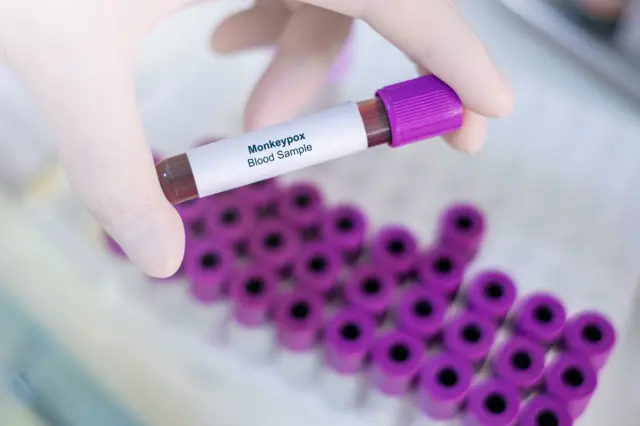 குரங்கம்மை