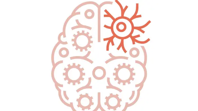 رسم لدماغ مريض بأجسام ليوي يظهر موقع تلف الخلايا العصبية