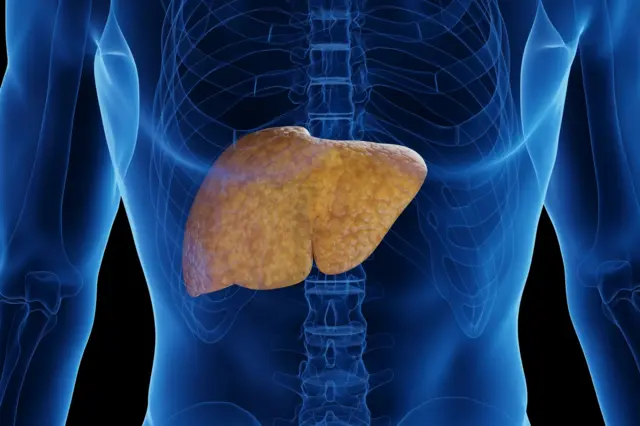 ምስሊ ሰብነት