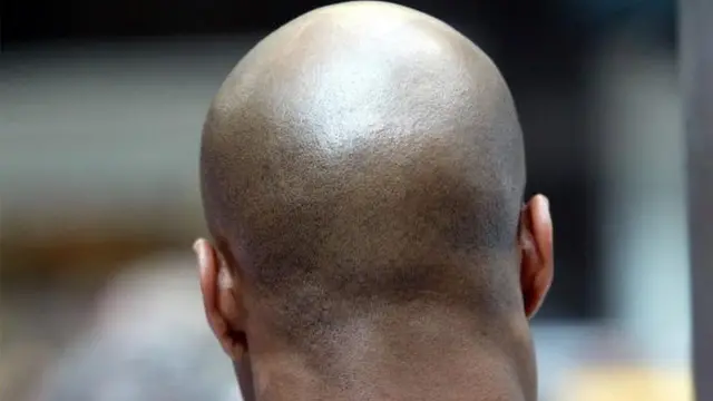 รูปด้านหลังคนหัวล้าน