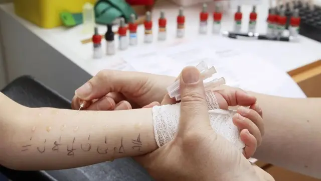 الحساسية الغذائية