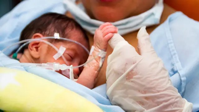 ప్రీ టర్మ్ బర్త్, నియో నేటల్ కేర్,  శిశువులు, హాస్పిటల్, ఐసీయూ