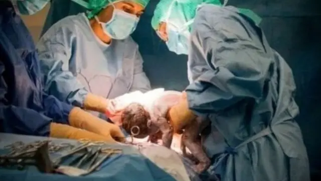 પ્રતીકાત્મક તસવીર