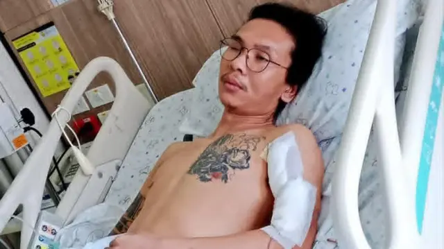 ဆေးရုံကုတင်ပေါ်လှဲလှောင်းနေတဲ့ အင်္ကျီဗလာနဲ့ ရင်ဘတ်မှာတက်တူးထိုးထားပြီး ဘယ်လက်မောင်းမှာ ခွဲစိတ်ထားတဲ့ဒဏ်ရာကို ပလက်စတာကပ်ထားတဲ့ အမျိုးသားတစ်ဦး